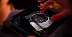 Samsung completes €86M takeover of French AI ultrasound startup Sonio